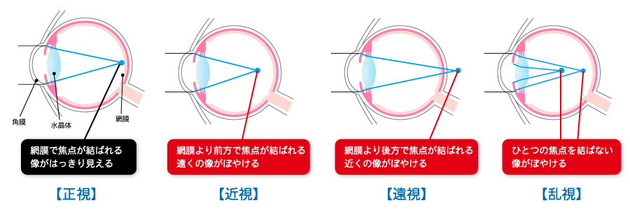 カメラのメガネ『Adjustigma』とは