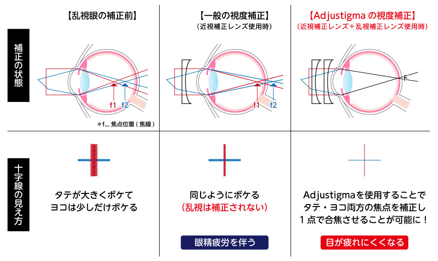Adjustigmaと通常の視度補正レンズの違い